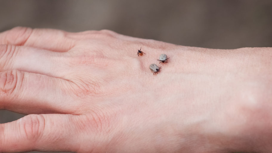 ТОП 6 методів як витягнути кліща 2 Як запобігти укусу кліща